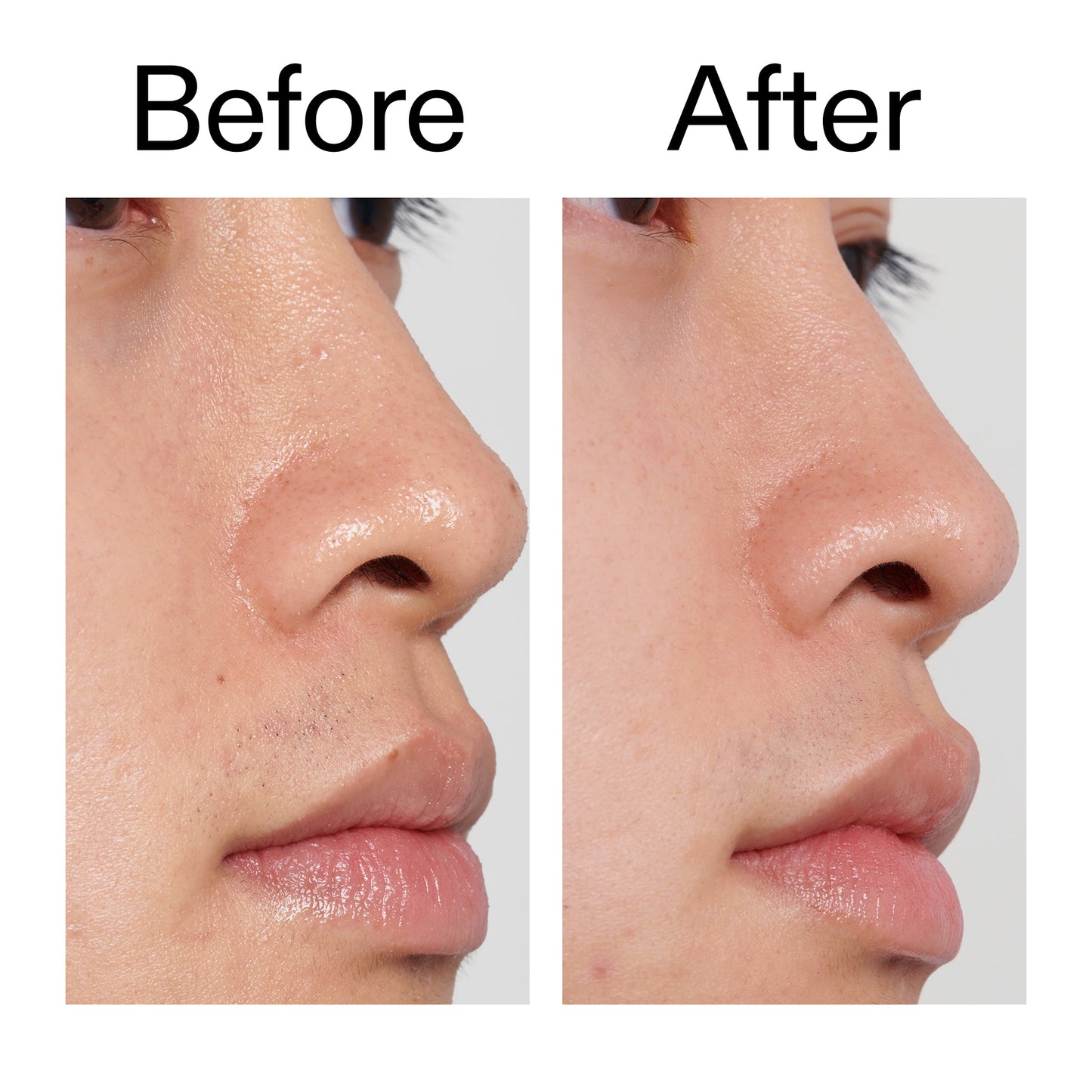 pha-toner-l9 PHA_Toner_Before_After_2000x2000_e3c10172-0150-4342-8b95-57417eaff50d.jpg