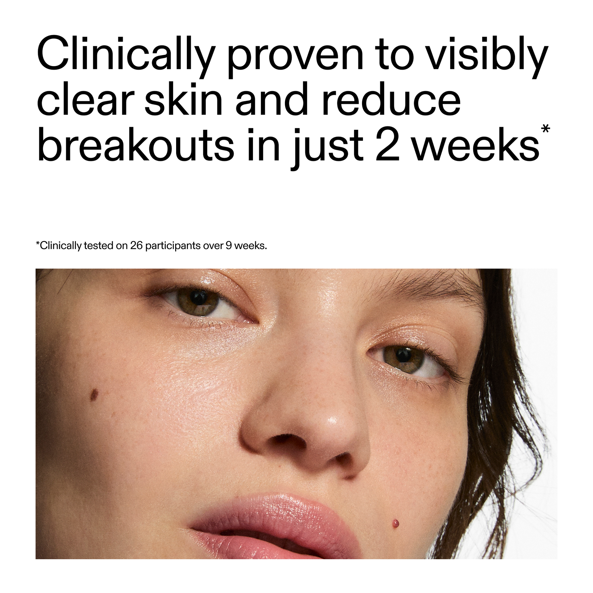 360-acne-clearing-duo-p7 360_Serum_Key_Claim.png