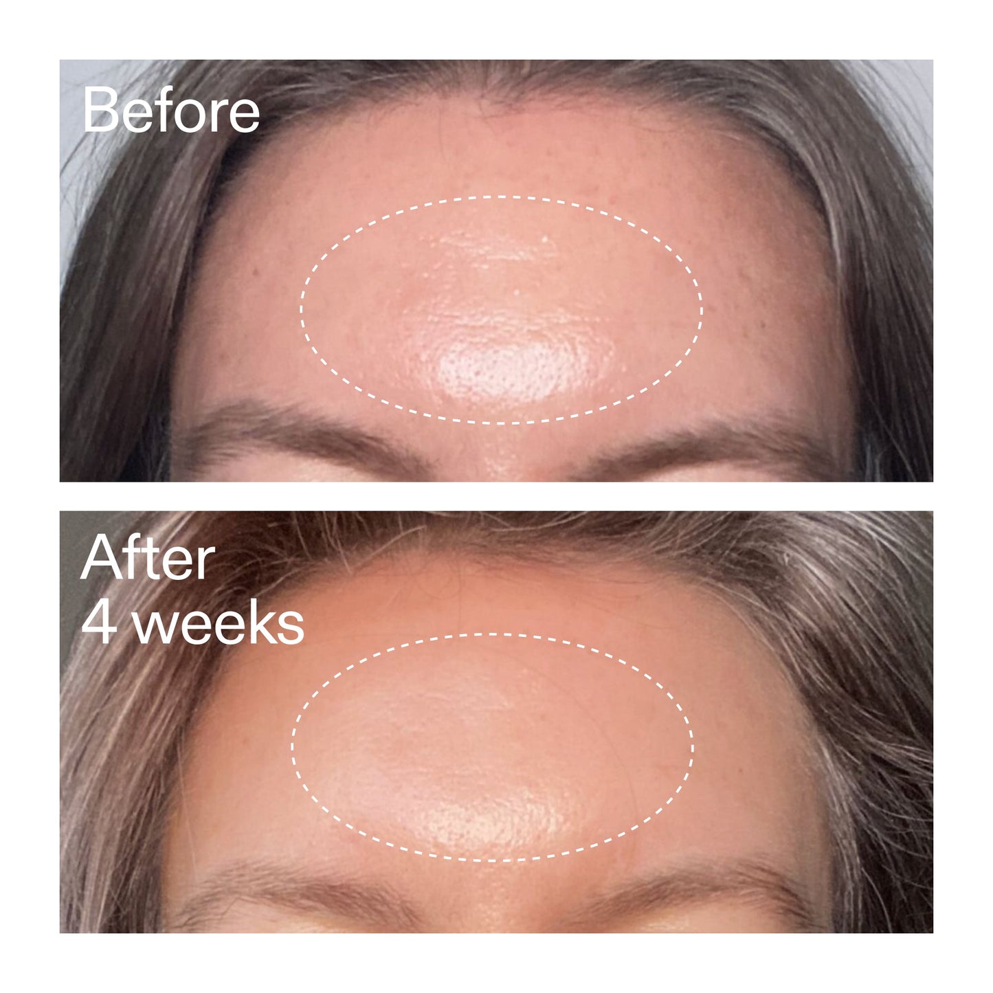 advanced-0-2-retinal-serum-r9 AdvancedRetinal_BeforeAfter1_2000x2000_1da6bb0a-29dd-41d1-95b7-8679696bbf0f.jpg