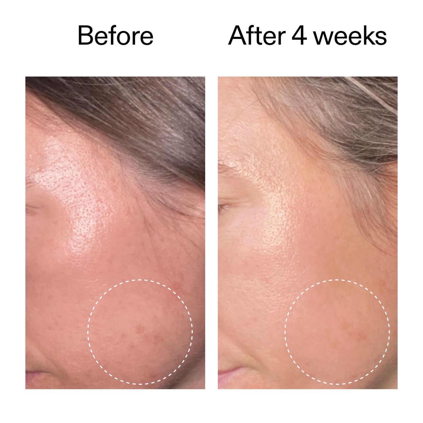 advanced-0-2-retinal-serum-r9 AdvancedRetinal_BeforeAfter2__2000x2000_62fb16bb-77ae-4d63-8500-88dbf847f4b9.jpg