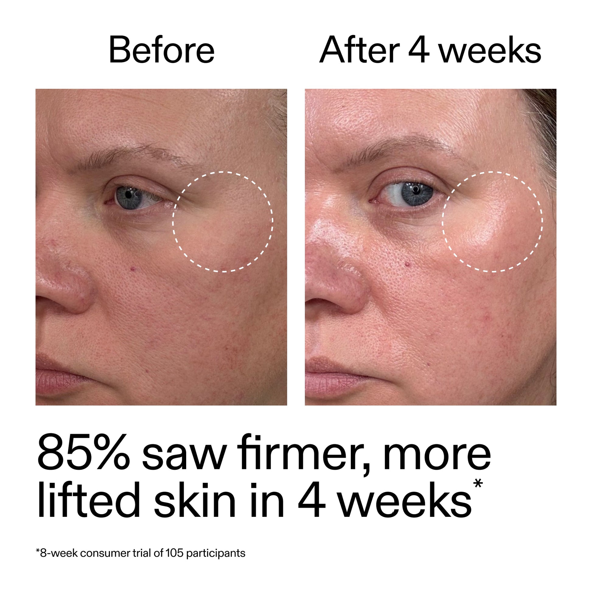 advanced-0-2-retinal-serum-r9 AdvancedRetinal_BeforeAfter_Claim1_2000x2000_bcc385c4-5e73-4f1e-aba8-64267937d0d3.jpg