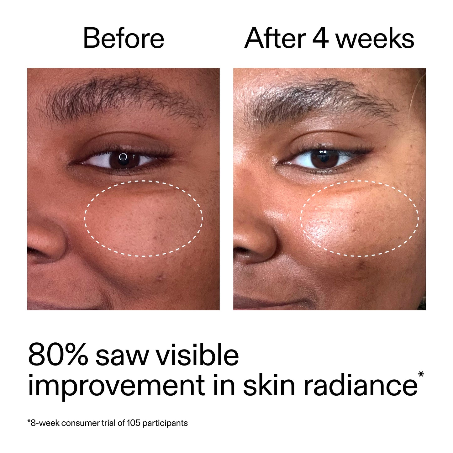 advanced-0-2-retinal-serum-duo-k3 AdvancedRetinal_BeforeAfter_Claim2_2000x2000_681b621d-8d44-4d44-9a40-89244f9b2e53.jpg