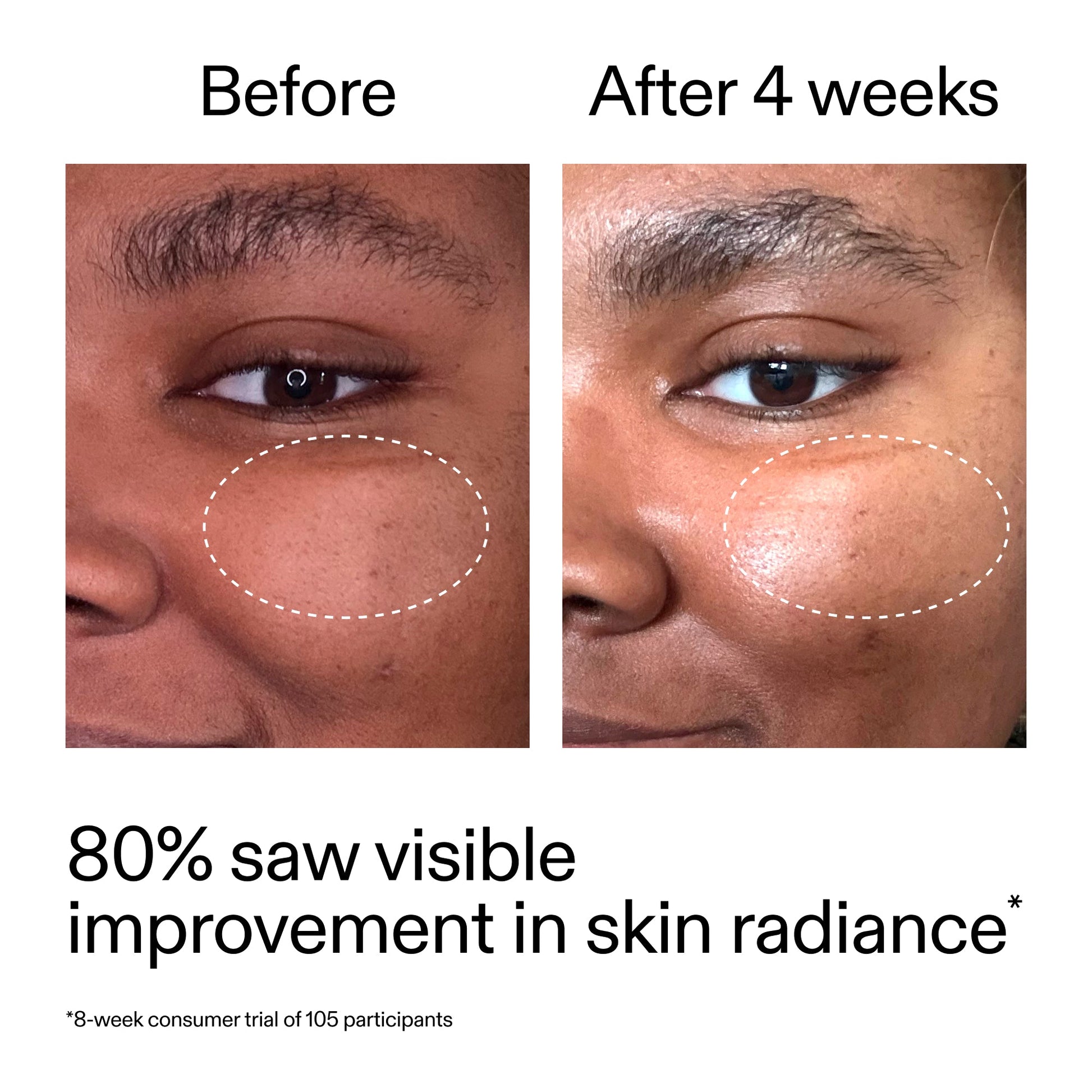 advanced-0-2-retinal-serum-duo-k3 AdvancedRetinal_BeforeAfter_Claim2_2000x2000_681b621d-8d44-4d44-9a40-89244f9b2e53.jpg
