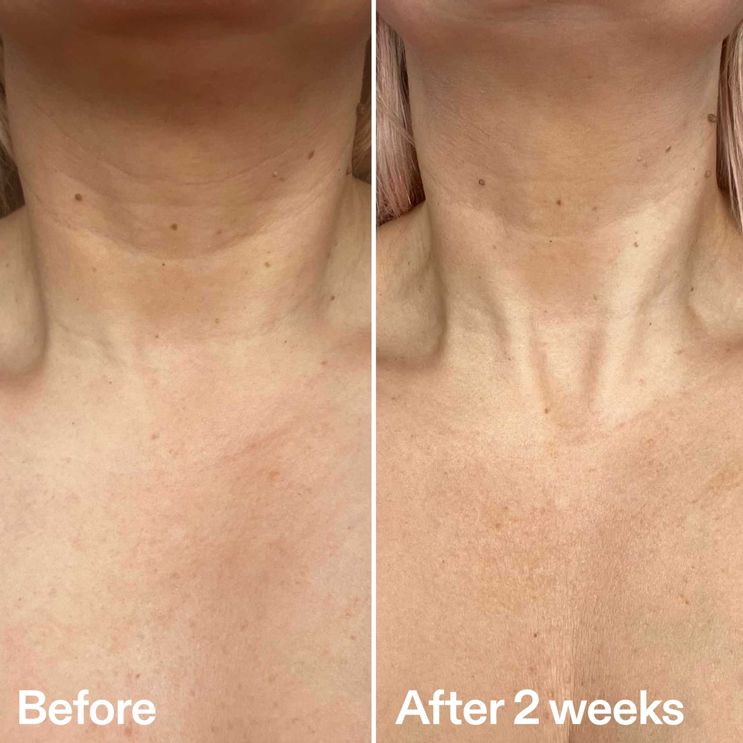 bio-active-neck-lift-stick-d7 B_A_2.jpg