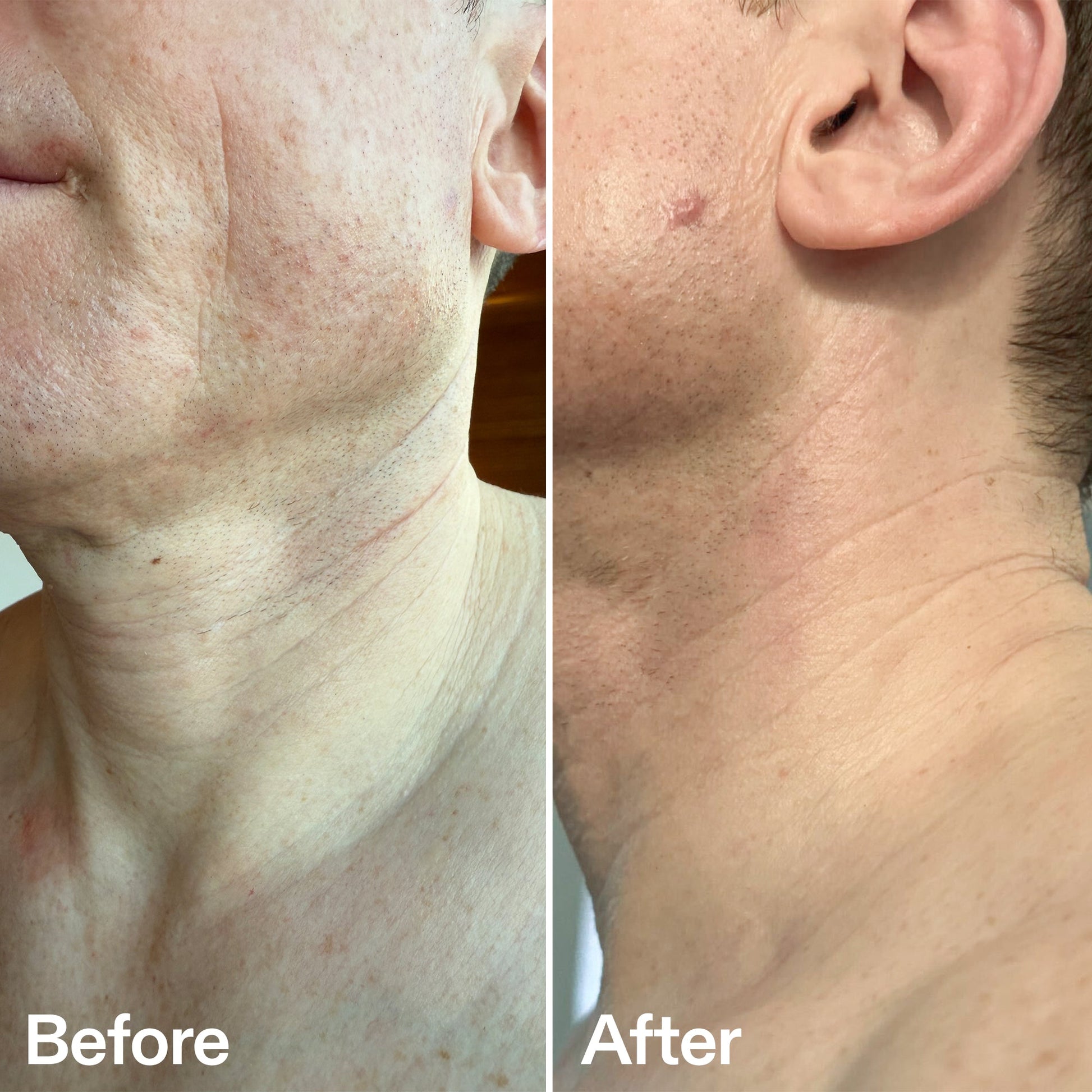 bio-active-neck-lift-stick-d7 B_A_afa2743e-b8e2-4504-92f4-e281cb6cf759.jpg