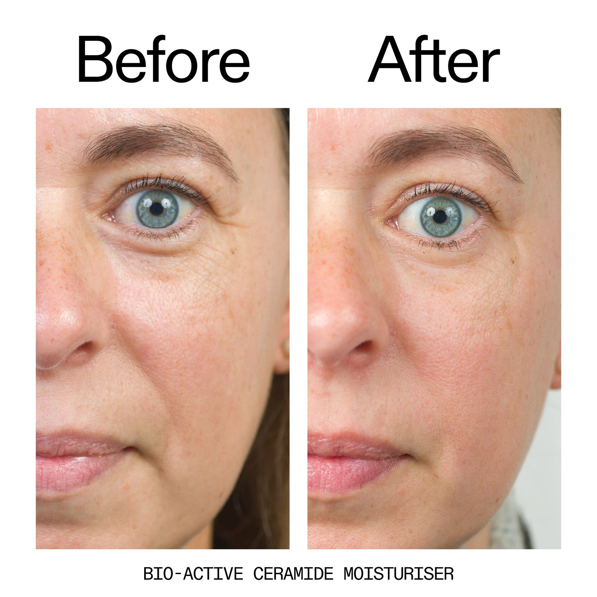 barrier-boosting-trio-u7 Bio-Active_Before_After_2000x2000_600947b4-e8c5-425a-9155-fc15bc83aa12.jpg