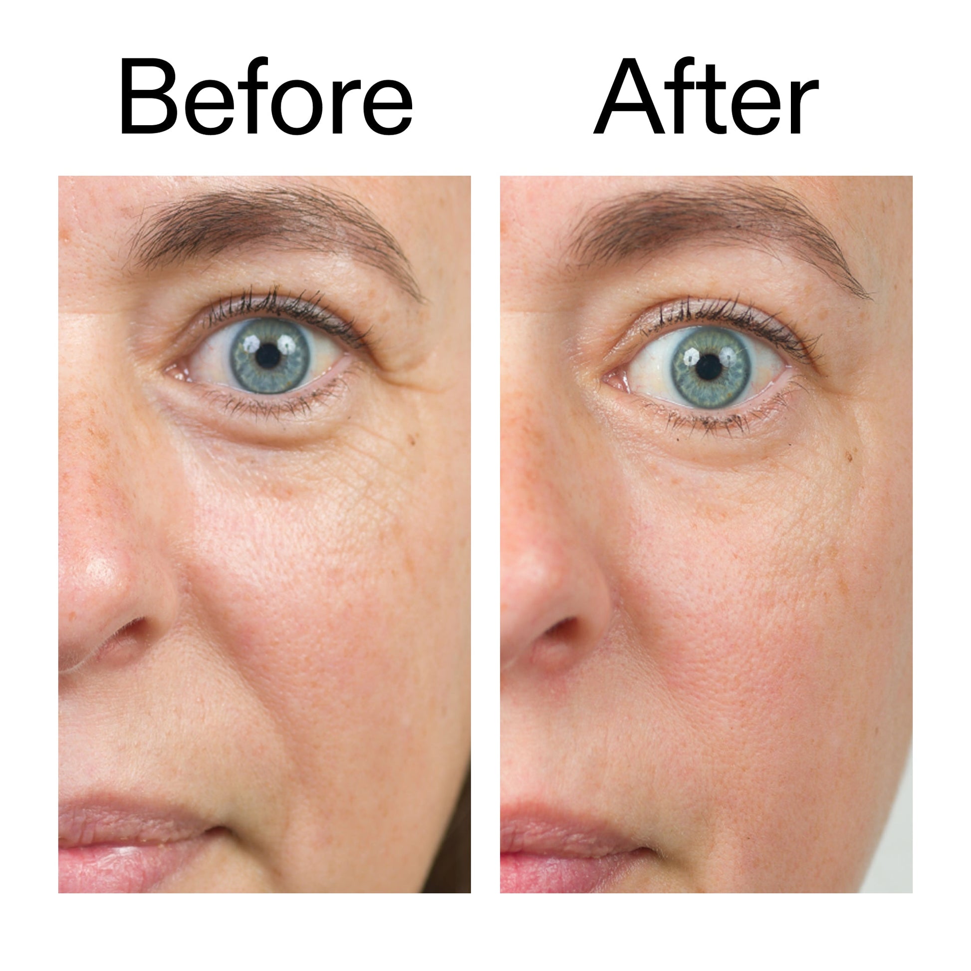 bio-active-ceramide-moisturizer-p7 Bio-Active_Before_After_2000x2000_566e5a9e-135e-417a-8242-b44e5fa35463.jpg