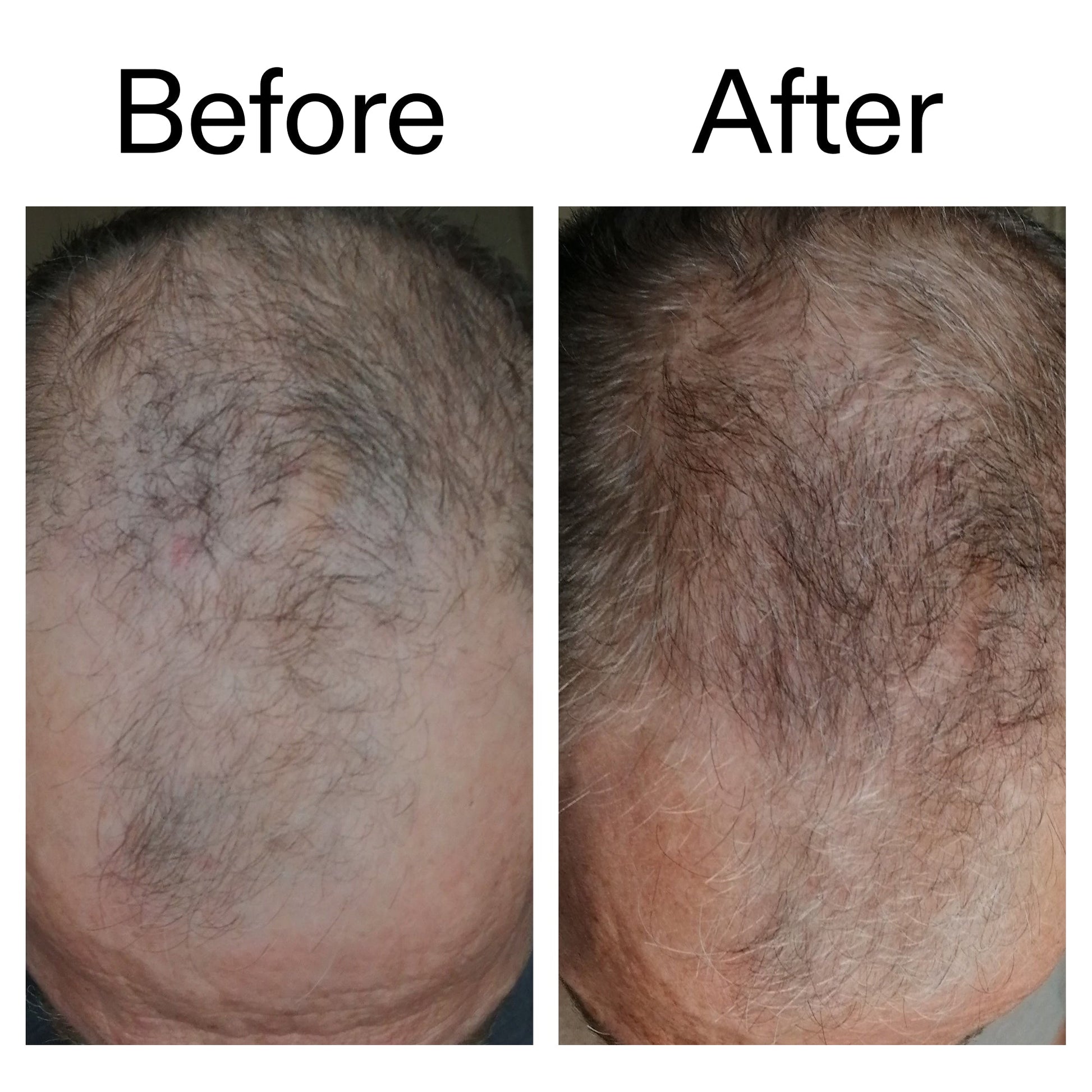 caffeine-stimulating-scalp-treatment-a4 Caffeine_Scalp_Treatment_B_A_Ppage_2000_x_2000.jpg
