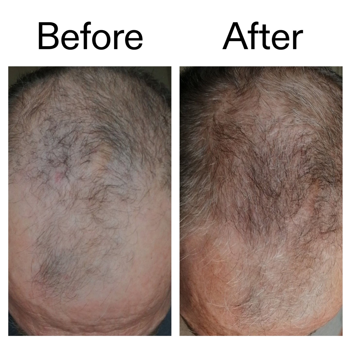 3-month-hair-growth-trio-y7 Caffeine_Scalp_Treatment_B_A_Ppage_2000_x_2000.jpg