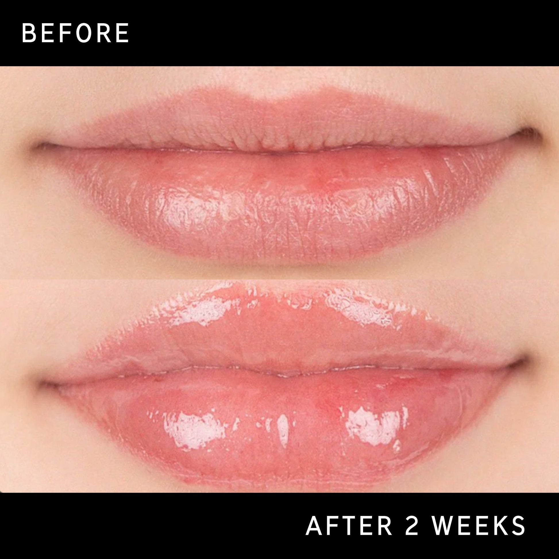 lip-plumping-duo-i3 DTC-Top15_Amends_Tripeptide-Lip_B_A.jpg