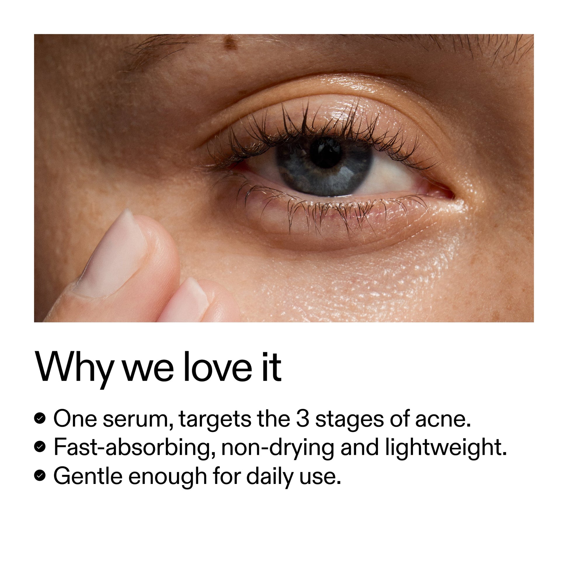 360-acne-clearing-duo-p7 Dioic_Whyweloveit_2000x2000_175aafd3-0cbe-403a-b317-a8362881bfe2.jpg