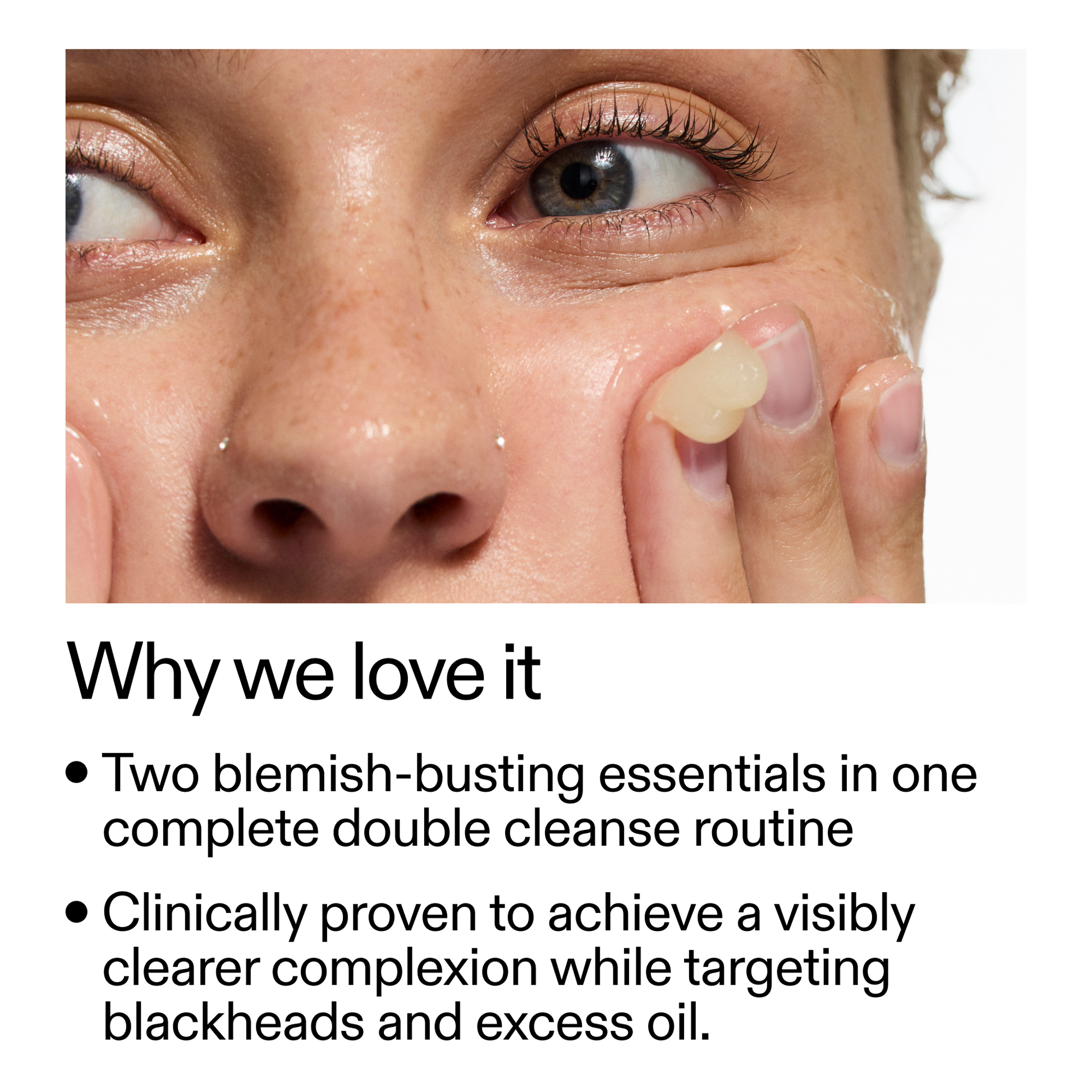 acne-double-cleanse-duo-l5 Double_Cleanse_Duo_for_Breakouts_Why_We_2000x2000_f242cb12-bb5c-487c-b203-071ccb406ec5.png