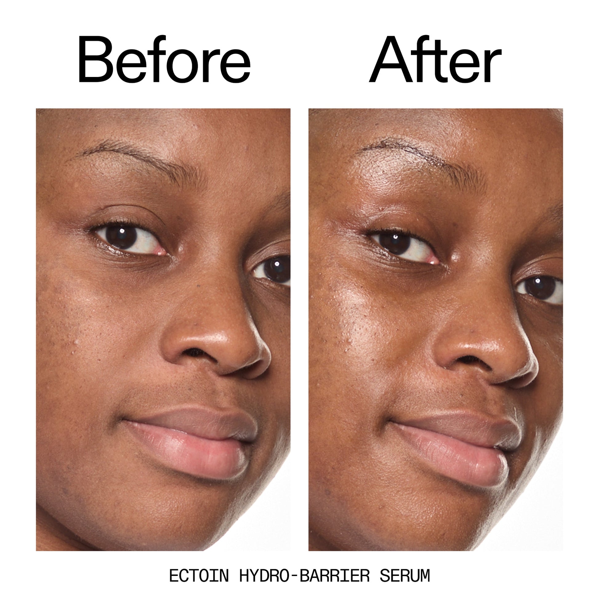 barrier-boosting-trio-u7 Ectoin_Before_After_2000x2000_ce35bc41-4da0-4b6f-adc7-29f8641f6c6c.jpg