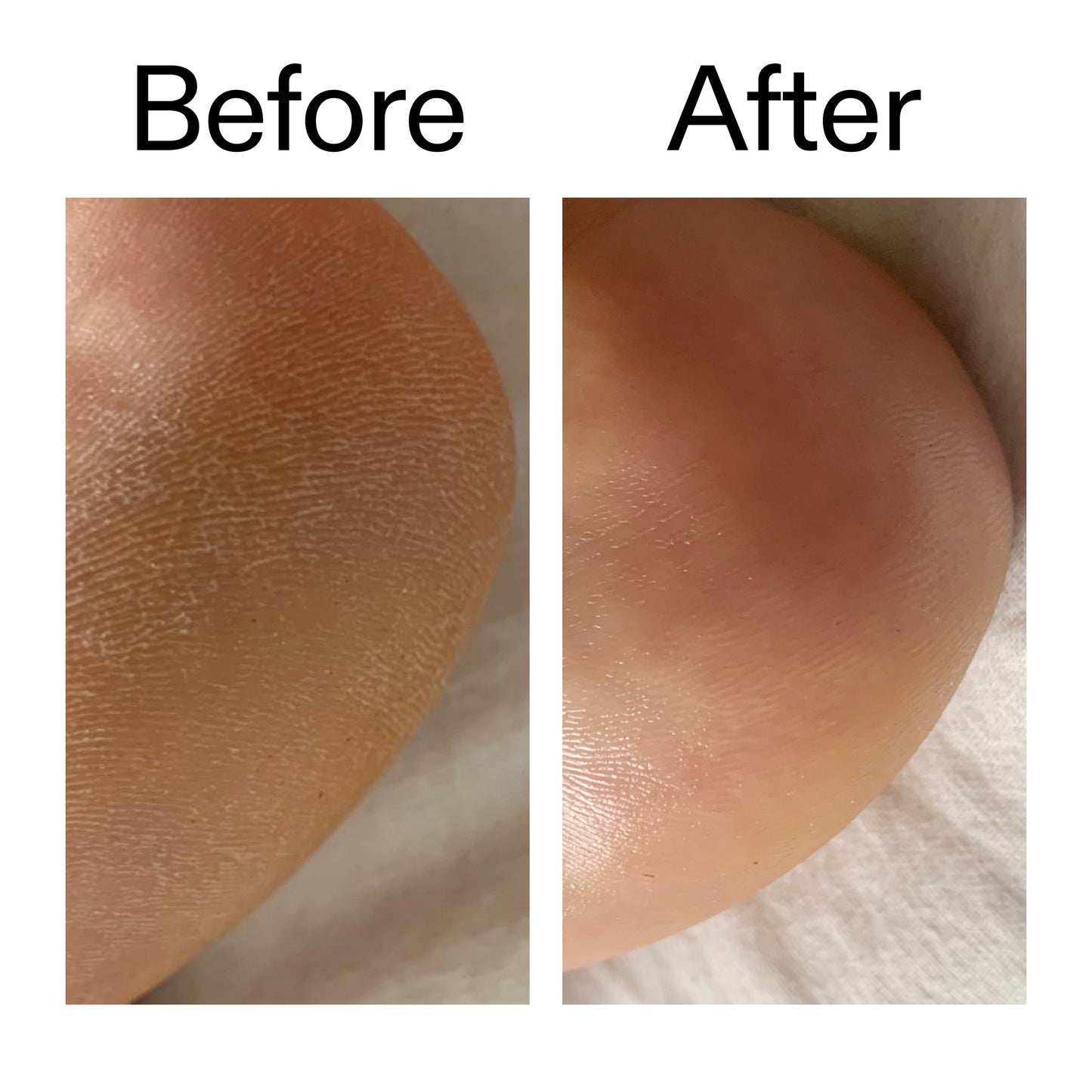glycolic-acid-exfoliating-body-stick-duo-u7 Glycolic_Acid_Exfoliating_Body_Stick_Before_After_V1_2000x2000_a3043625-9400-429a-a7fb-d6dbd220f722.jpg