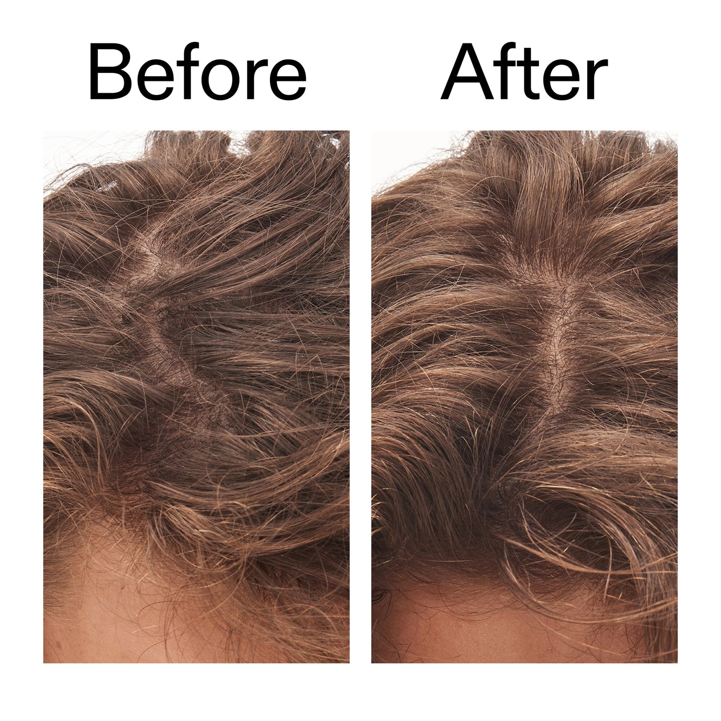 glycolic-acid-exfoliating-scalp-scrub-a3 Glycolic_Acid_Exfoliating_Scalp_Scrub_Before_After_2000x2000_b8561c87-05a1-4caa-80f7-1b6b33d750f7.jpg