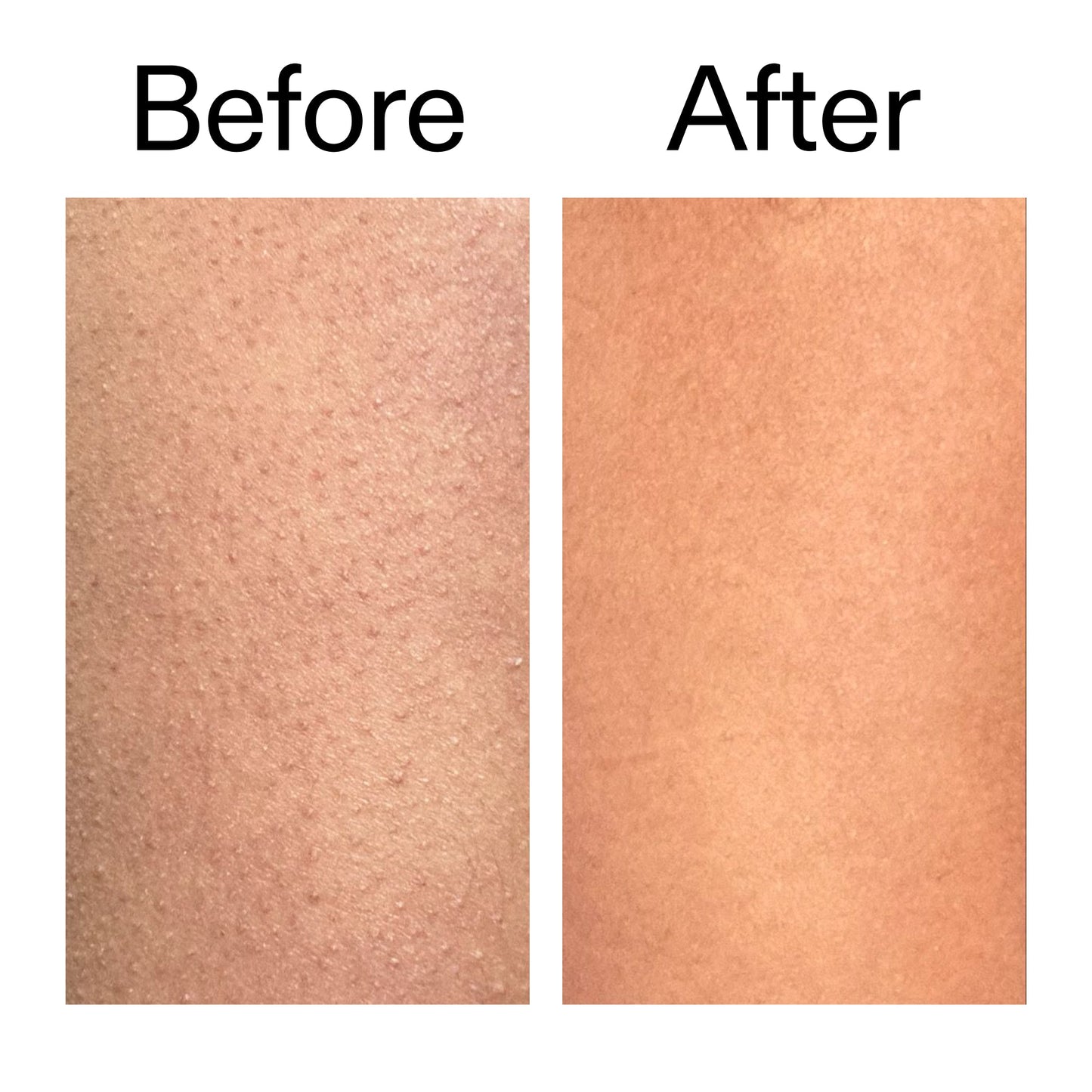 glycolic-acid-exfoliating-body-stick-duo-u7 Glycolic_Body_Stick_B_A_2000x2000_6e6e6b4d-5bd7-43c0-aeed-4d66788e8995.jpg