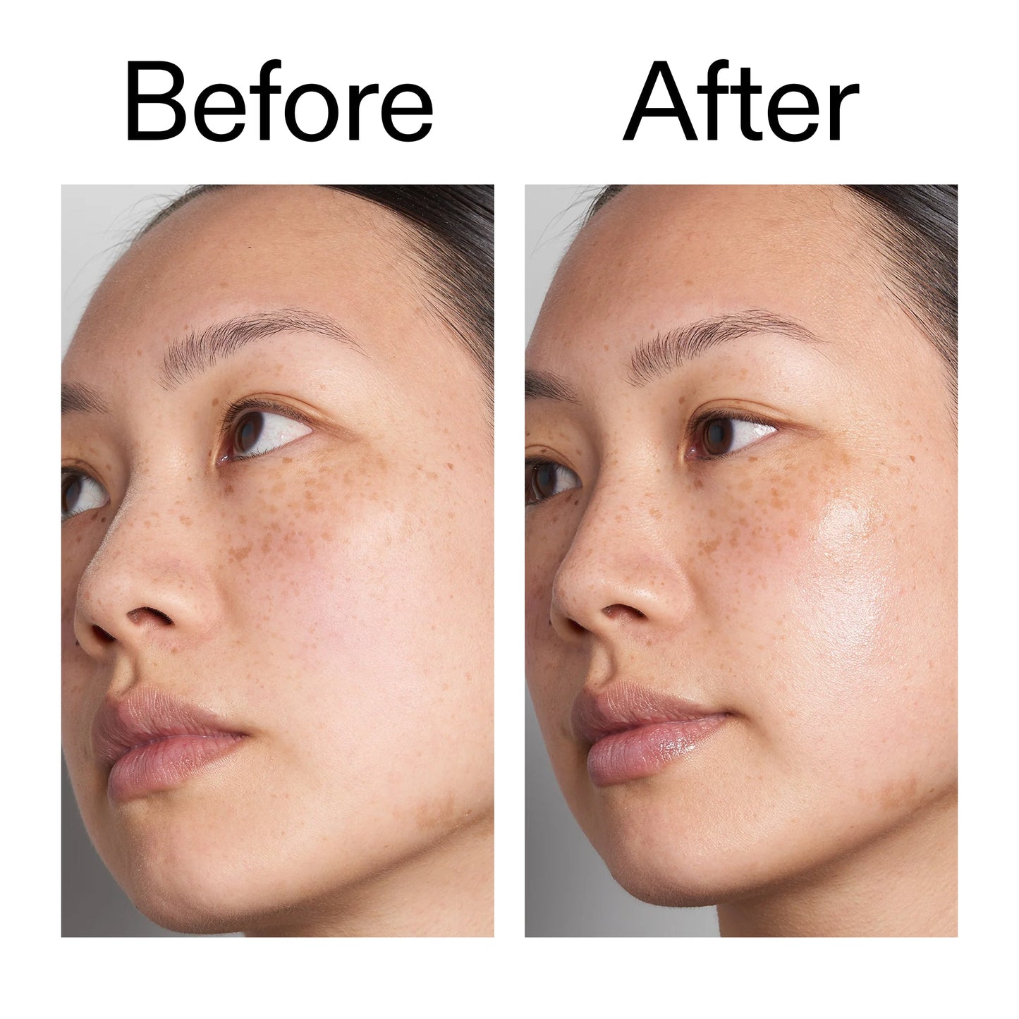 hyaluronic-acid-serum-60ml-duo-w8 Hyaluronic_Acid_Before_After_2000x2000_d566f5ba-a77e-4585-99fd-0f4682b164dd.jpg