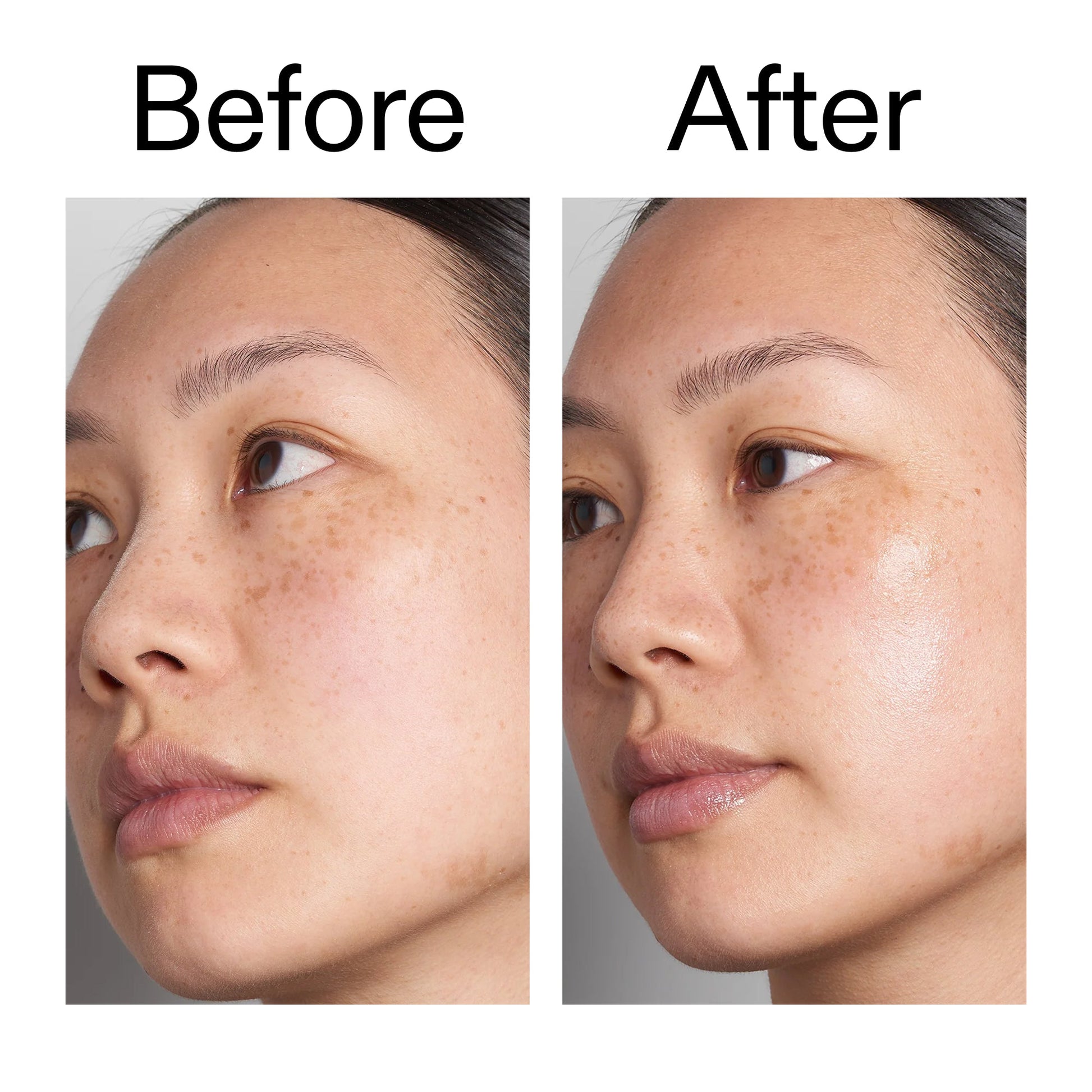 hyaluronic-acid-serum-60ml-duo-w8 Hyaluronic_Acid_Before_After_2000x2000_d566f5ba-a77e-4585-99fd-0f4682b164dd.jpg
