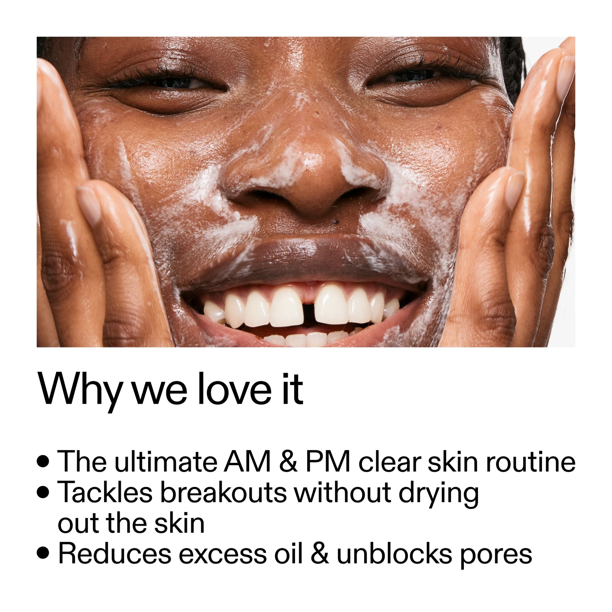 intro-routine-for-acne-m6 Intro_Routine_for_Acne_Why_we_love_it_2000x2000_42499e10-4629-4a0e-a627-7e215f4da6bc.jpg