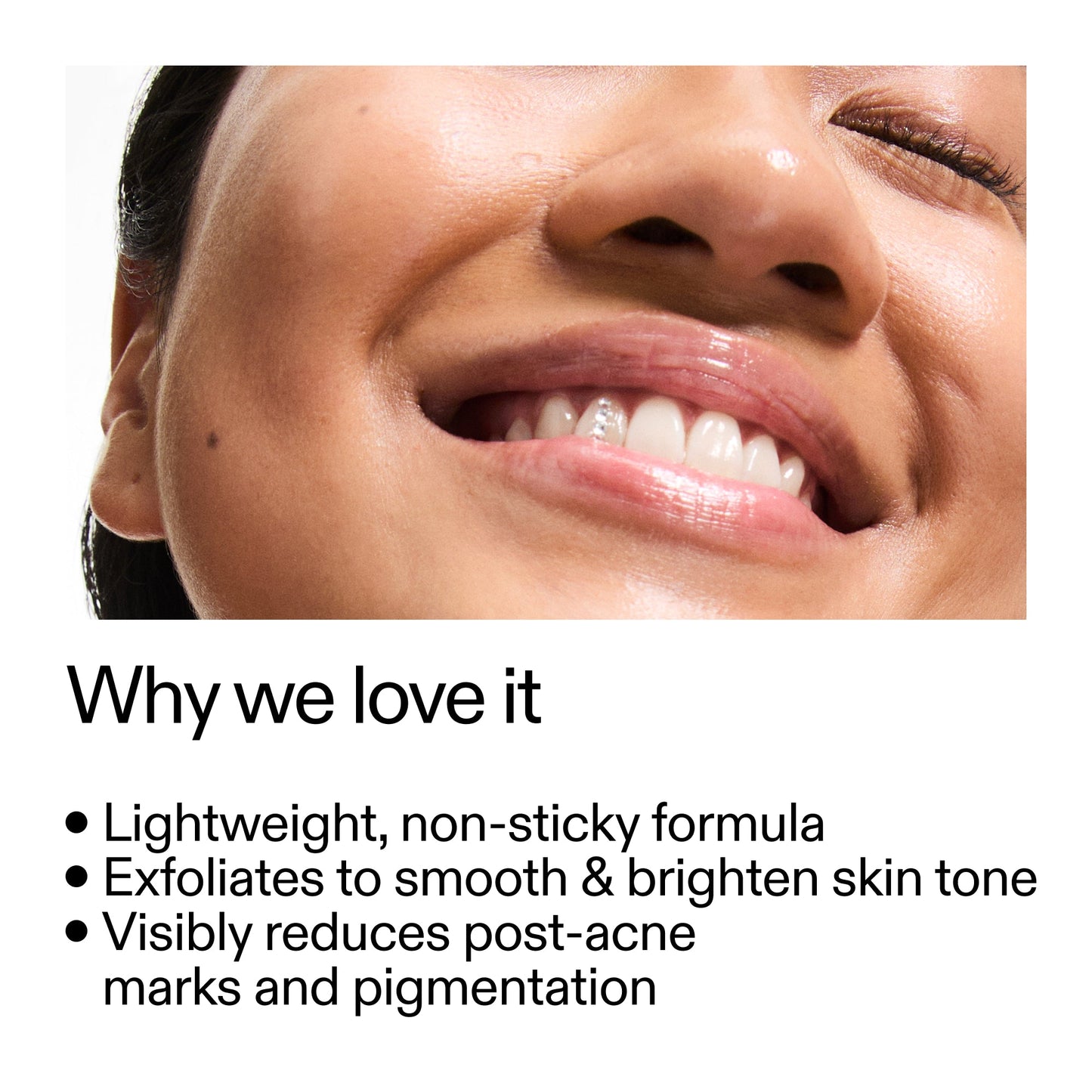 mandelic-acid-treatment-a0 Mandelic_Acid_Treatment_Why_we_love_it_2000x2000_6dfe29a9-2a79-464f-a5e8-e5ac37d93388.jpg