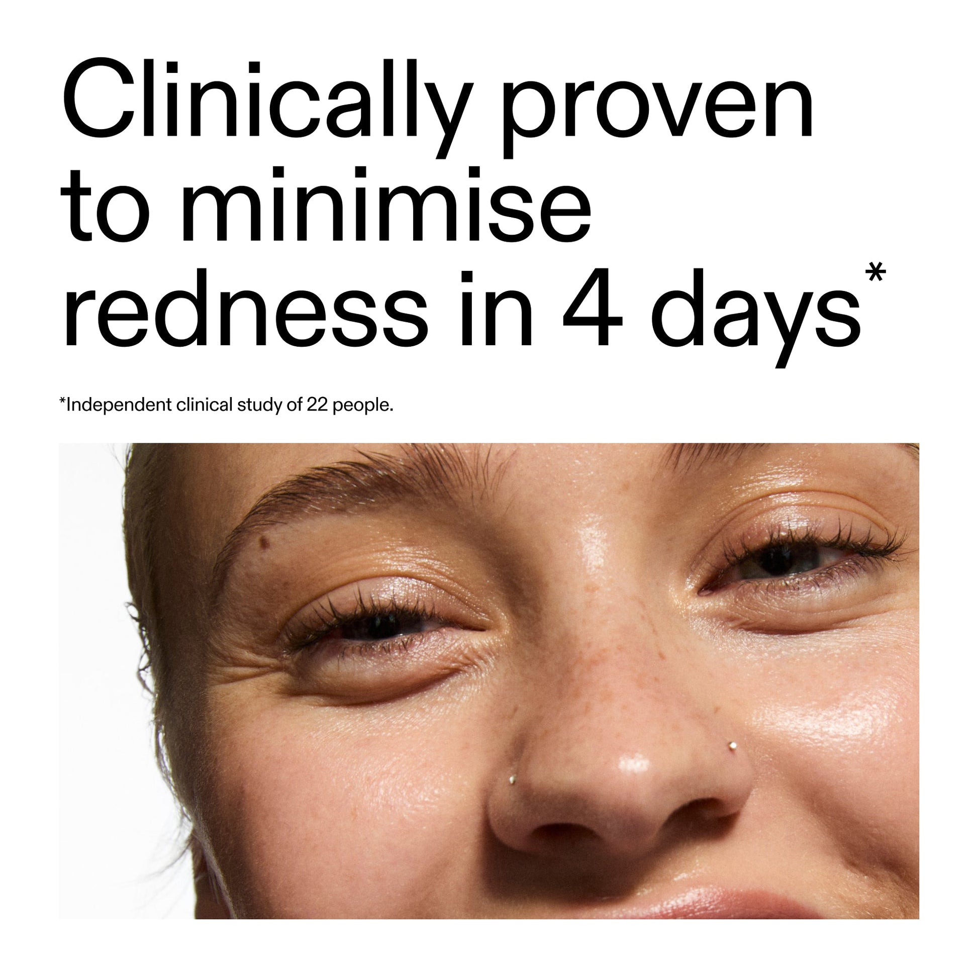 10-azelaic-acid-serum-for-redness-relief-w6 Oat_Cleansing_Balm_Claim_2000x2000_52a841dc-353c-4f2c-8646-3aadb604507d.jpg
