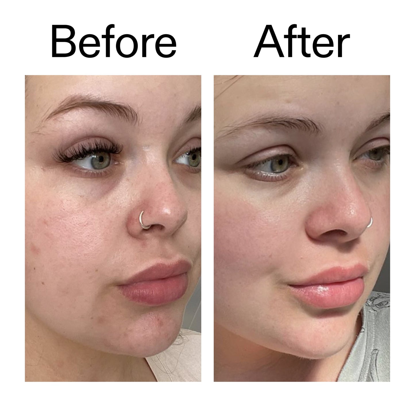 supersize-omega-water-cream-100ml-v4 Omega50_Before_After_2000x2000_46483ed8-3f9d-487f-9a0c-9df79830bd65.jpg