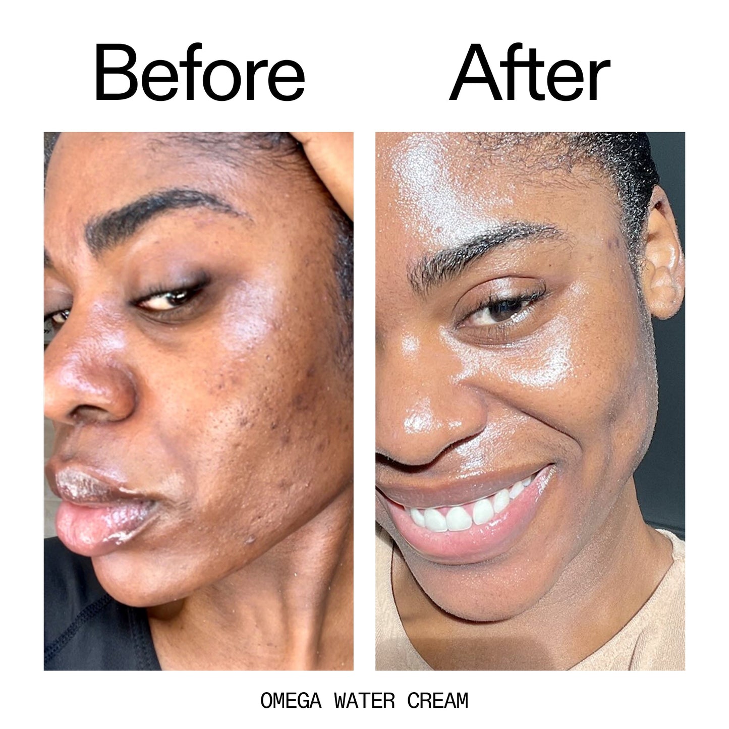 hydrating-cleanser-and-moisturizer-duo-c0 Omega_Water_Cream_Before_After_2000x2000_8e88278b-8c8d-48dc-ac77-4e98ebbd1b77.jpg