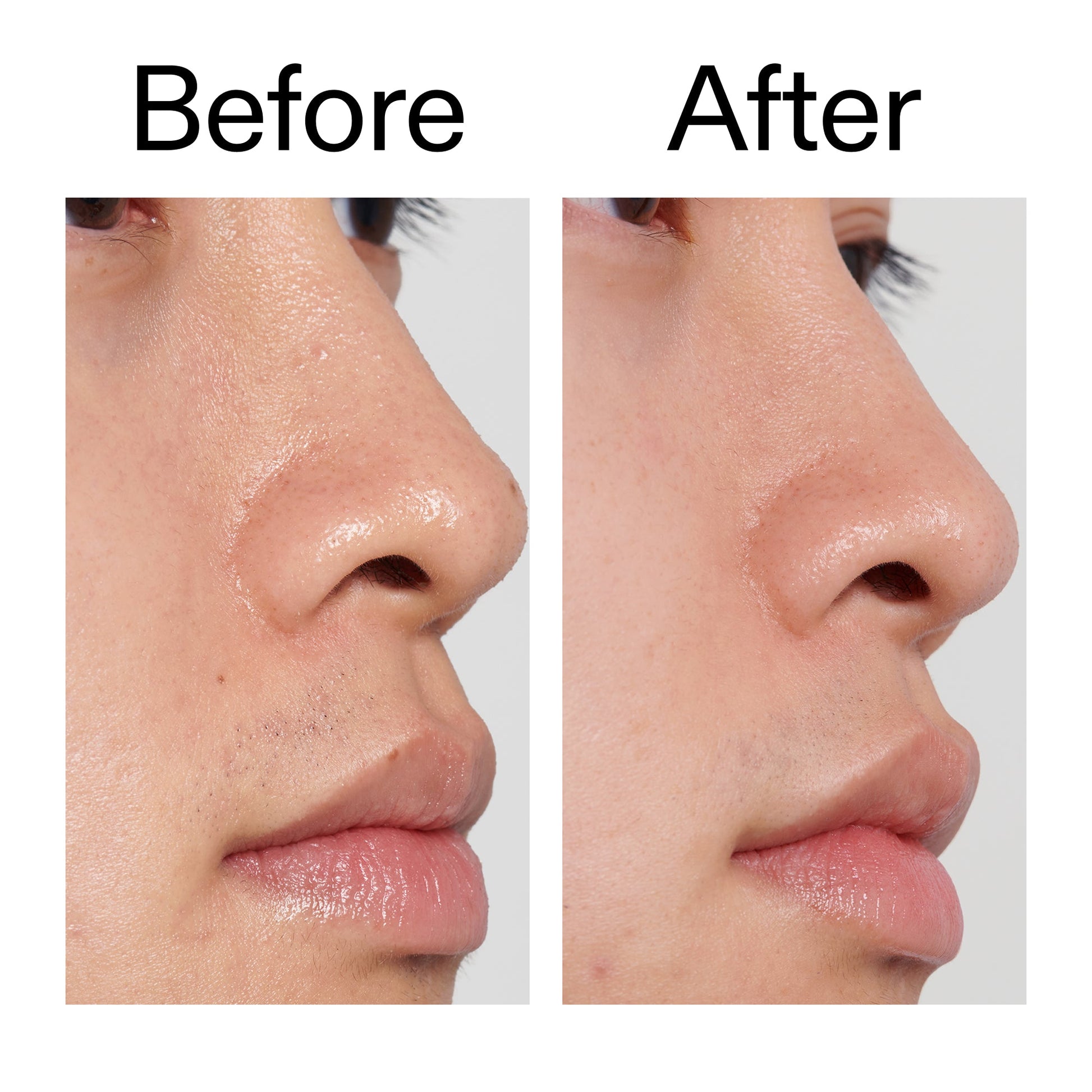 pha-toner-l9 PHA_Toner_Before_After_2000x2000_e3c10172-0150-4342-8b95-57417eaff50d.jpg
