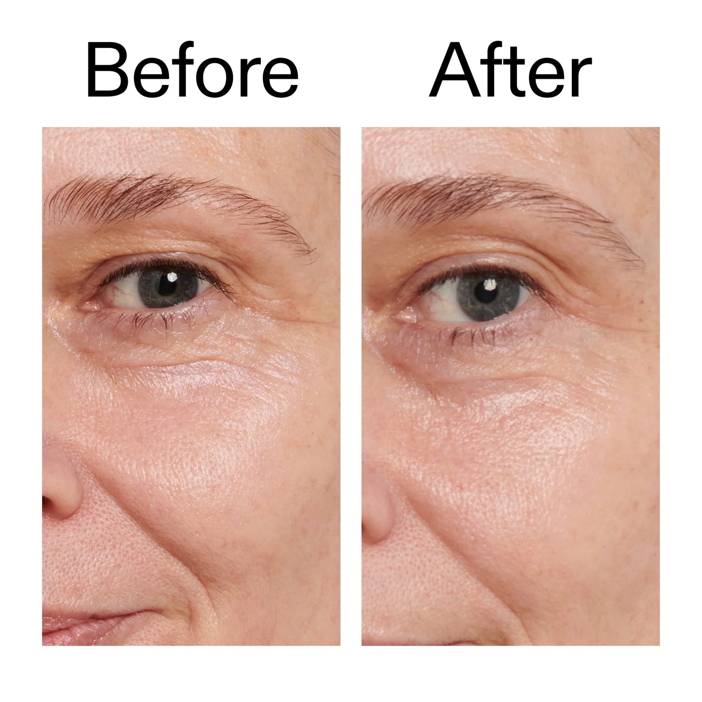 retinol-eye-cream-h8 Retinol_Eye_Cream_Before_After_2000x2000_ac03a80c-109e-4572-a95a-91dc109b4d27.jpg