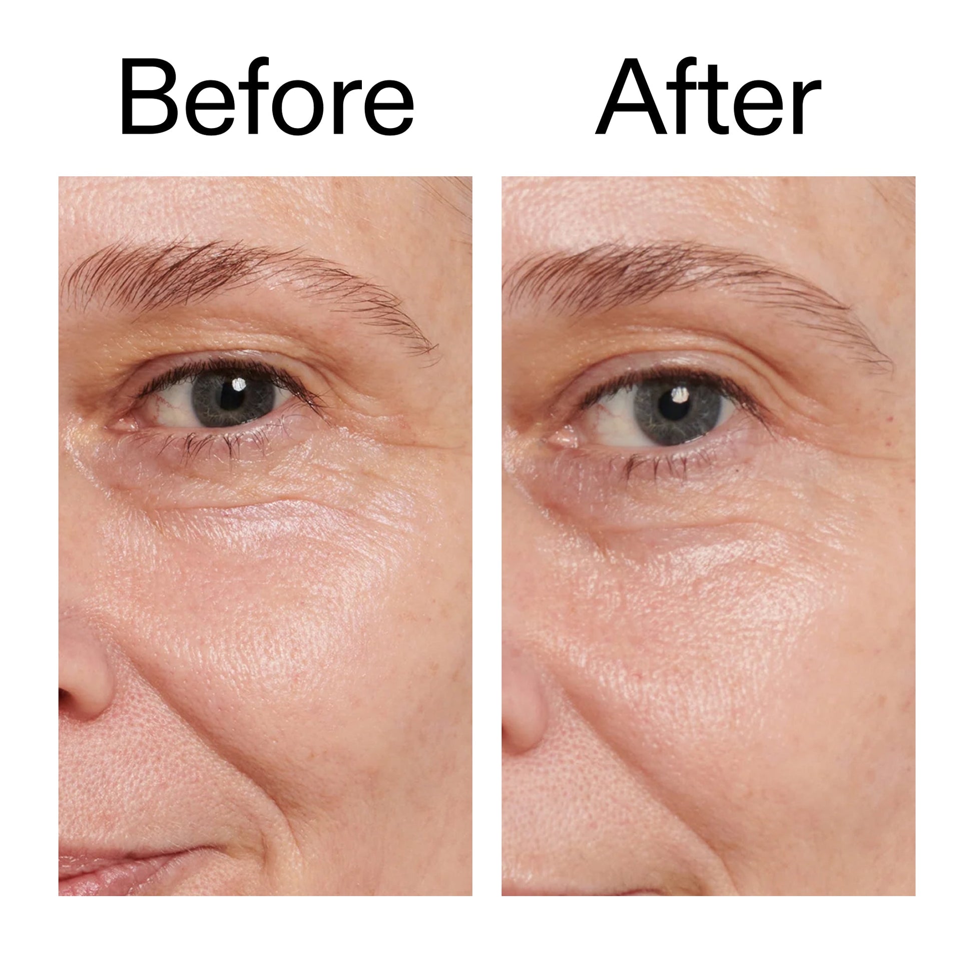 retinol-eye-cream-h8 Retinol_Eye_Cream_Before_After_2000x2000_ac03a80c-109e-4572-a95a-91dc109b4d27.jpg