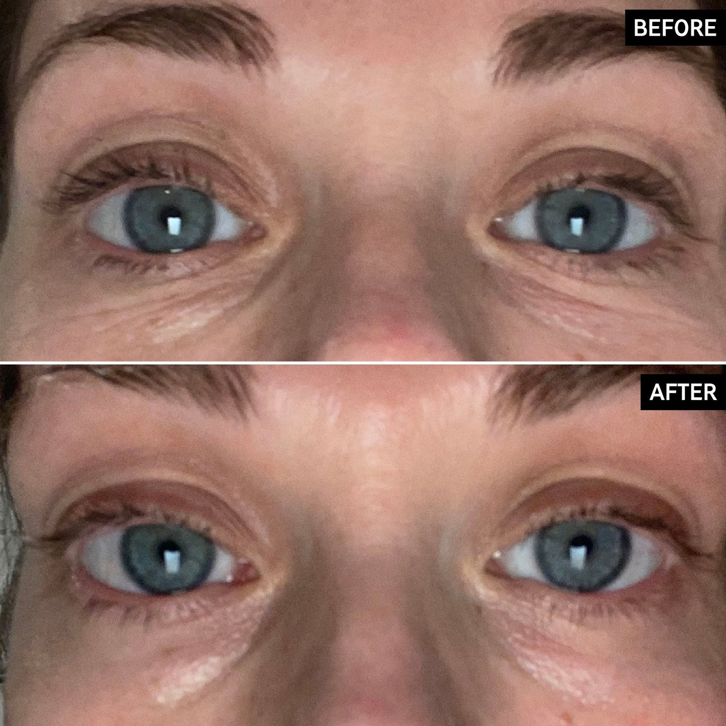 retinol-eye-cream-h8 SITE-UGCBAsApril_Nicole_B_A_PPage_2000x2000_1.jpg