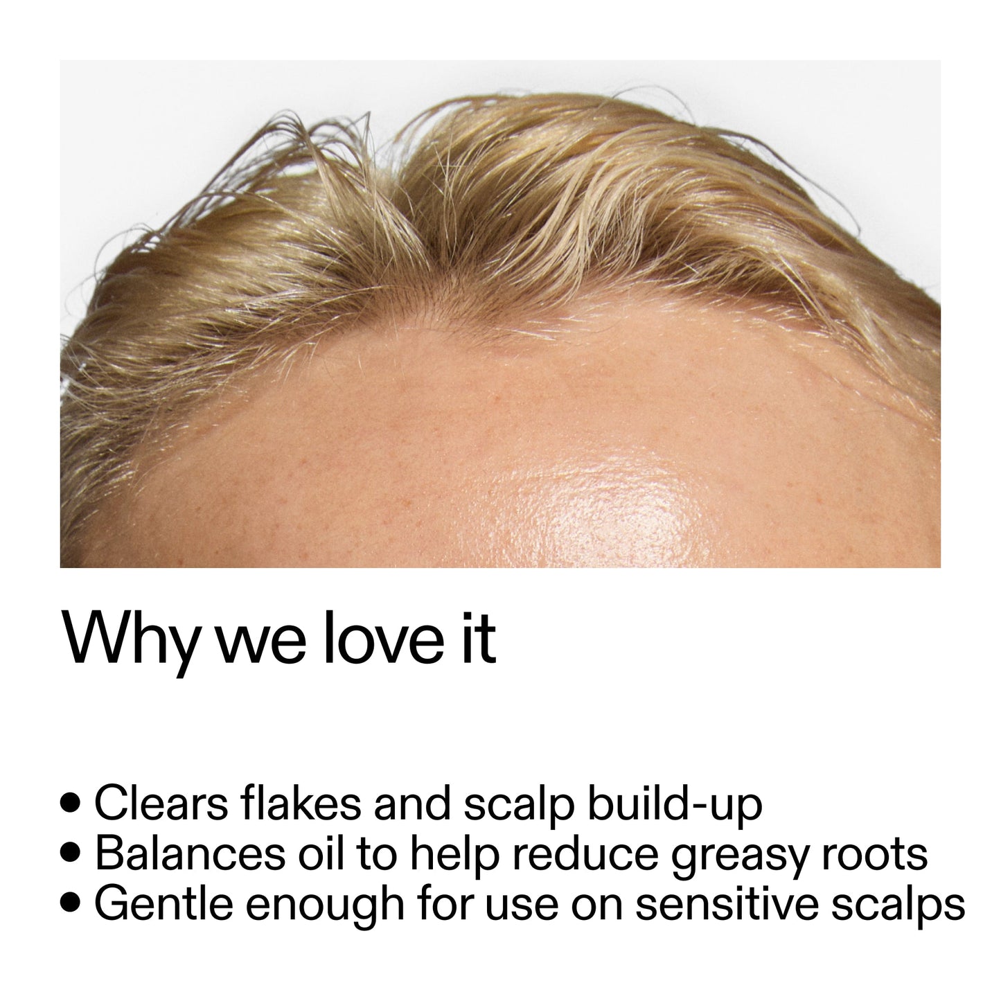 salicylic-acid-exfoliating-scalp-treatment-k9 Salicylic_Acid_Exfoliating_Scalp_Treatment_Why_we_love_it_2000x2000_44b6bd6d-9ec4-4b23-9dc4-bc3fd6f28e14.jpg