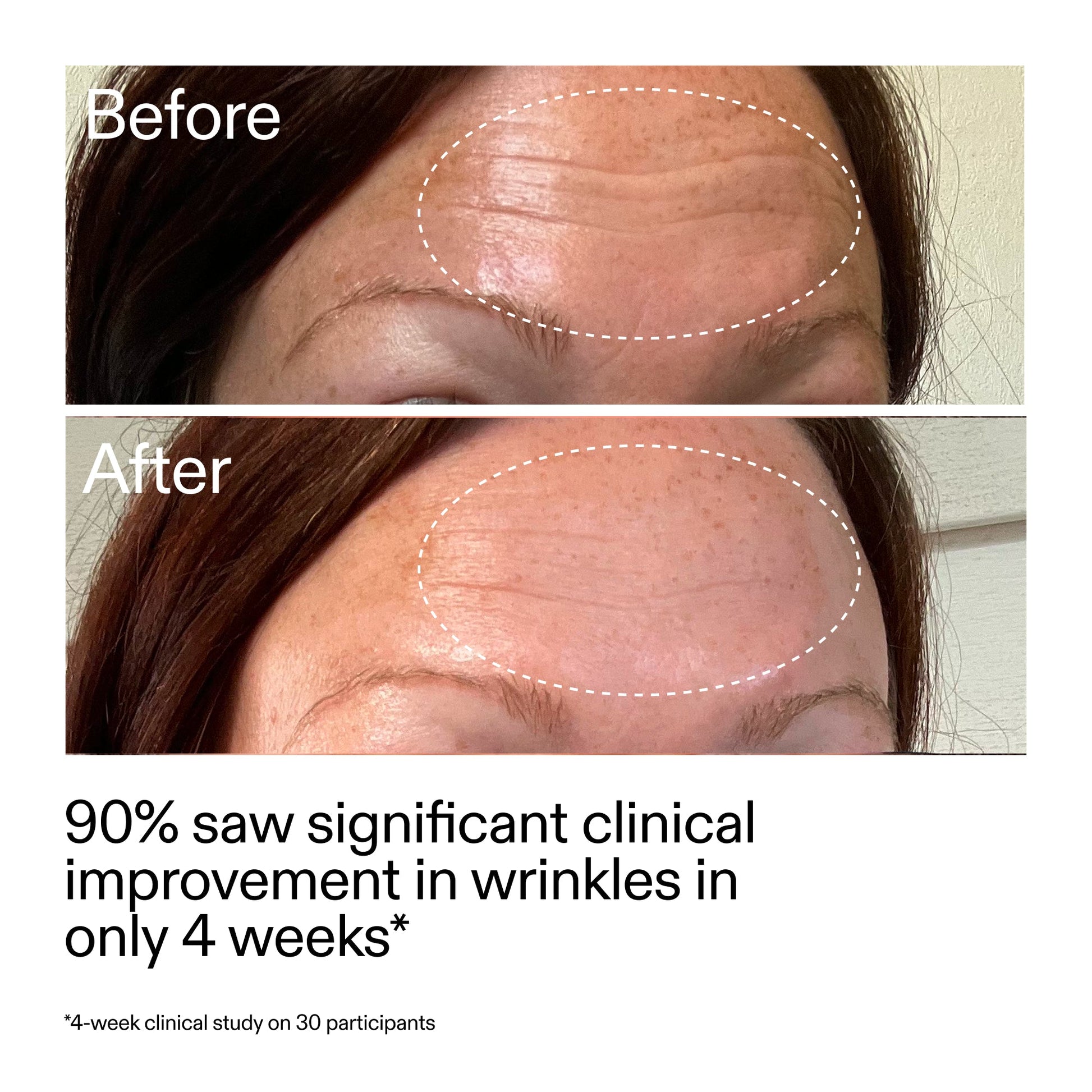 starter-retinol-serum-duo-b6 StarterRetinol_BeforeAfter_Claim1_2000x2000_03b4d6e5-a357-43b9-a855-aba5e35c57f3.jpg