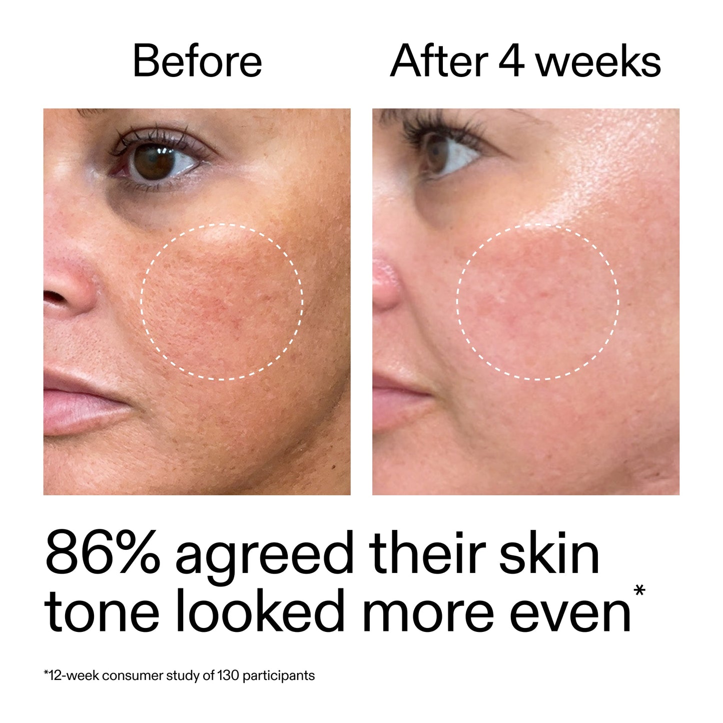 starter-retinol-serum-duo-b6 StarterRetinol_BeforeAfter_Claim2_2000x2000_fc5bb8ac-8588-478f-98d5-28af6651601a.jpg