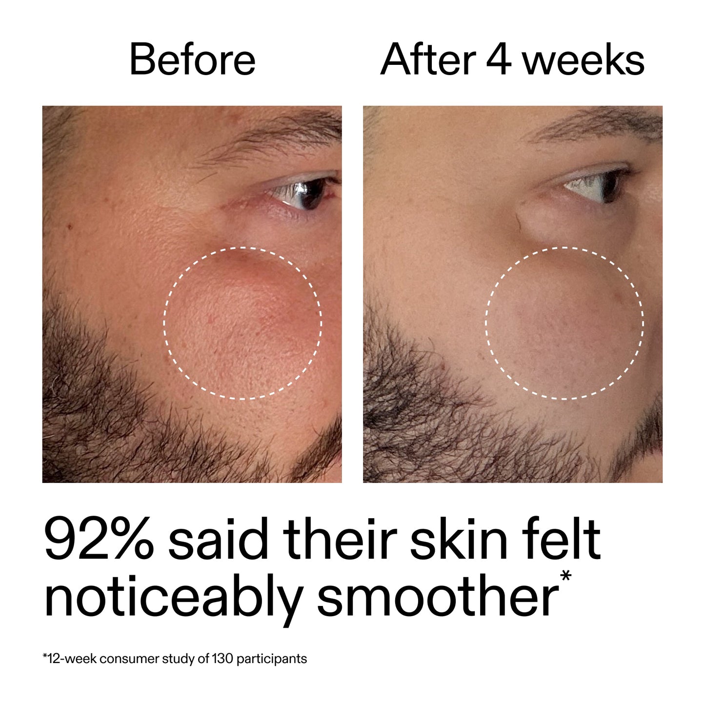 starter-retinol-serum-r9 StarterRetinol_BeforeAfter_Claim3_2000x2000_6ceab106-e0ee-4ed4-ba62-41bc39538038.jpg
