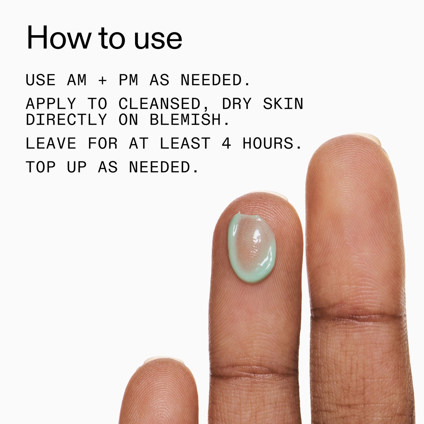 succinic-acid-acne-treatment-m1 Succinic_Acid_Treatment_How_to_Use_2000x2000_d57137d5-d7f1-427c-9a46-5fc00c19c542.jpg