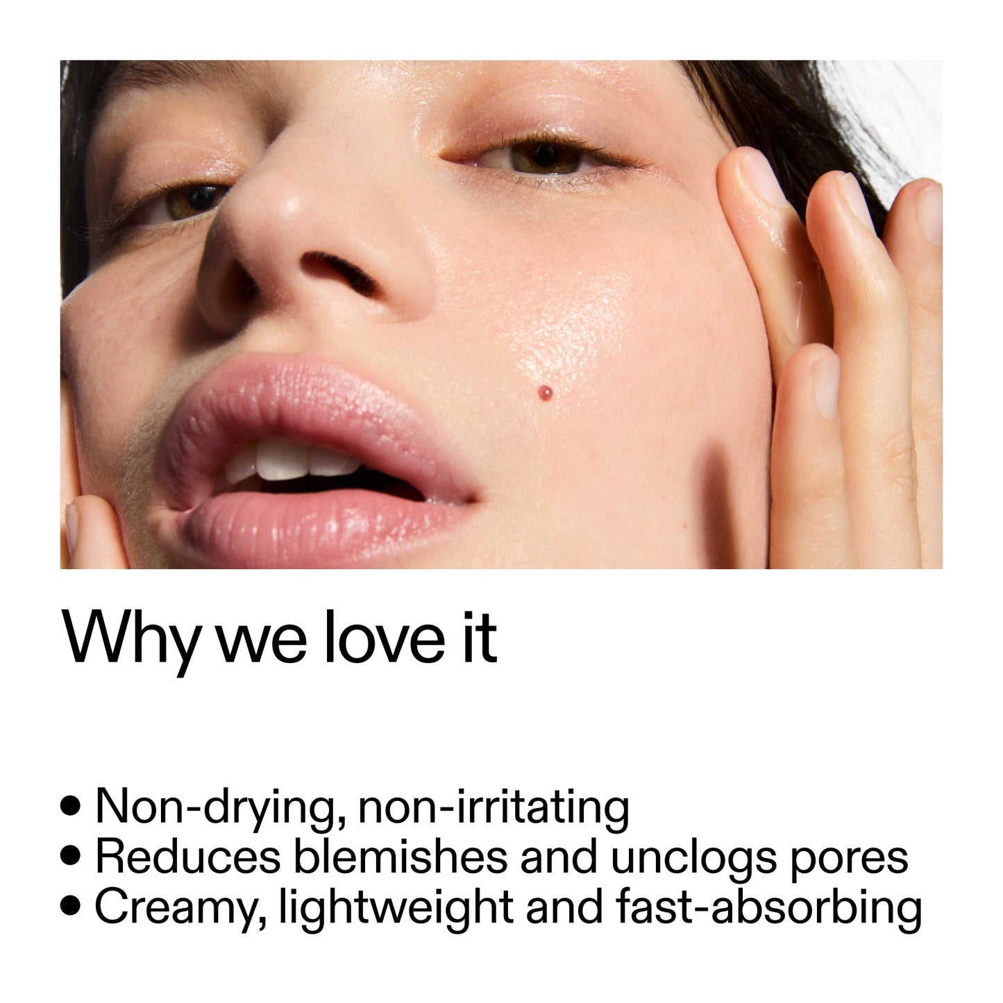 succinic-acid-acne-treatment-m1 Succinic_Acid_Treatment_Why_we_love_it_2000x2000_e90dd42a-cfe9-48b5-a2c7-d5eda787a6a8.jpg