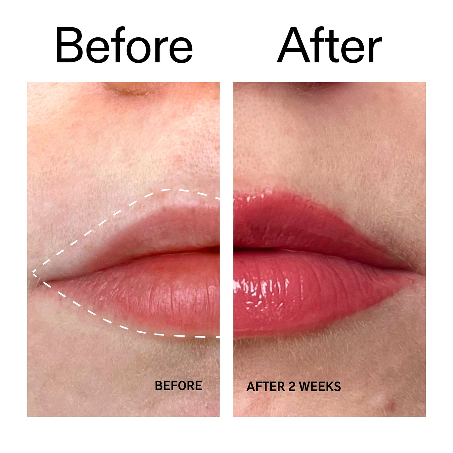tripeptide-plumping-berry-lip-balm-l0 Tripeptide_Plumping_Lip_Balm_-_Berry_Before_After_2000x2000_9474bbd8-43ca-4b0e-b0e7-dfab70b91927.jpg