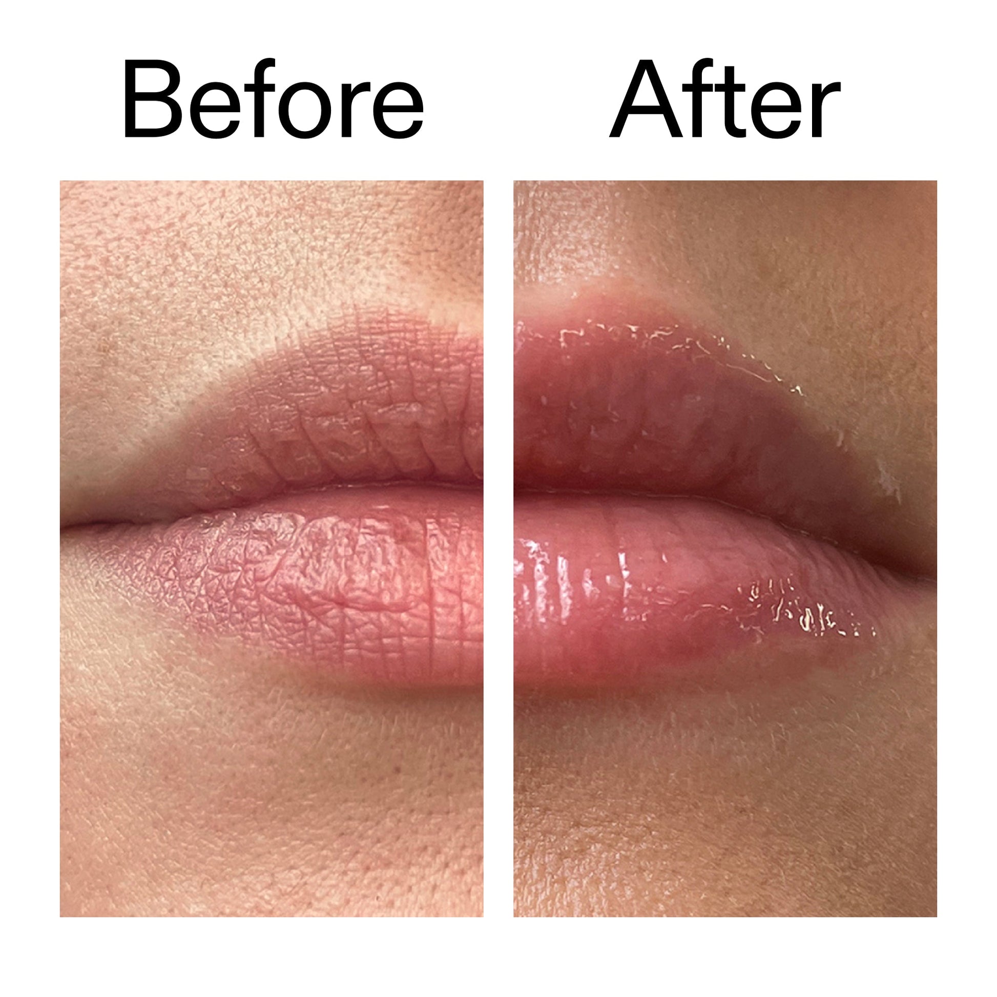 lip-plumping-duo-i3 Tripeptide_Plumping_Lip_Balm_Before_After_2000x2000_b4a5ee04-d2ac-4857-8f01-17209acc4bf3.jpg