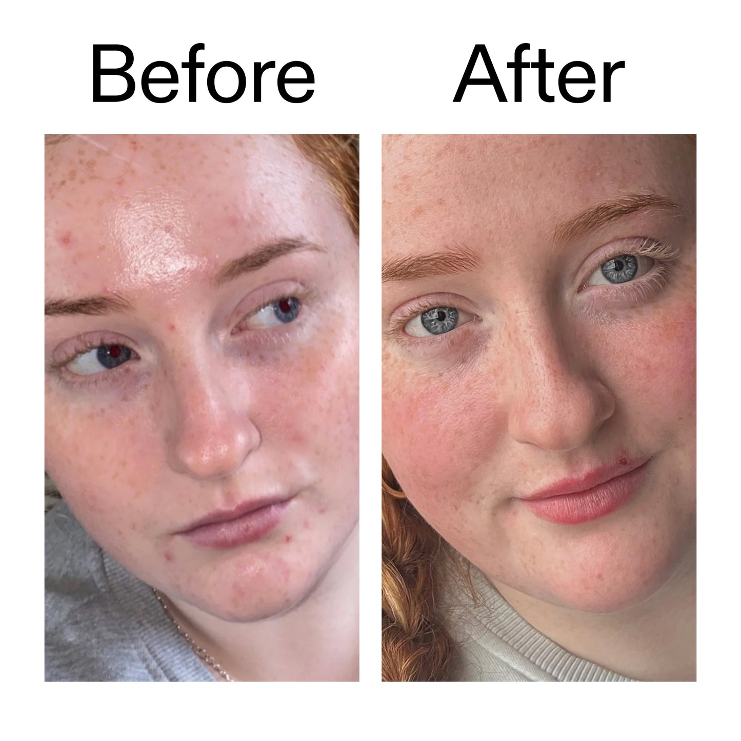 vitamin-b-c-and-e-moisturizer-s7 Vitamin_B_C_and_E_Moisturizer_Before_After_2000x2000_b0781a76-5ad2-4be9-95b8-ef92b356833c.jpg